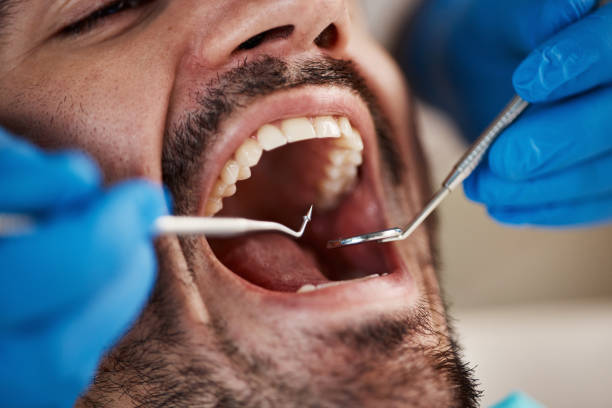 Best Emergency Dental Filling Replacement  in Meadville, PA